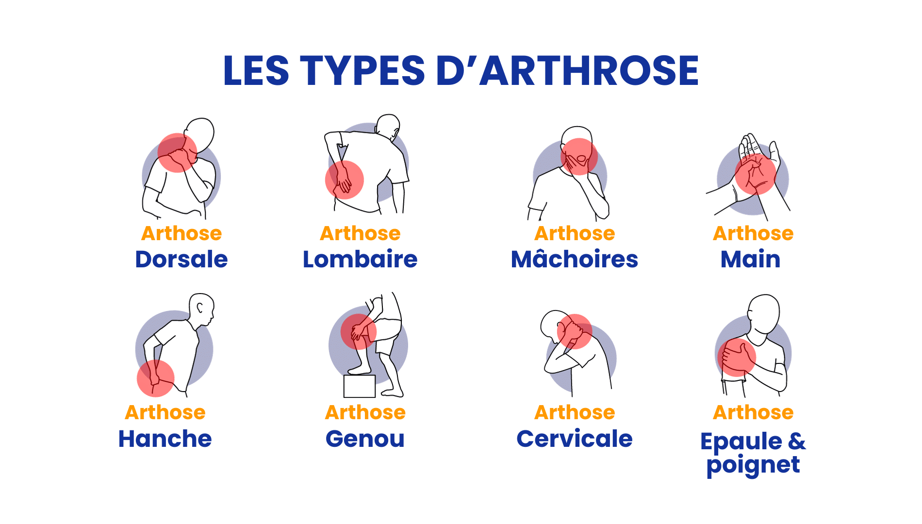 les types d'arthrose